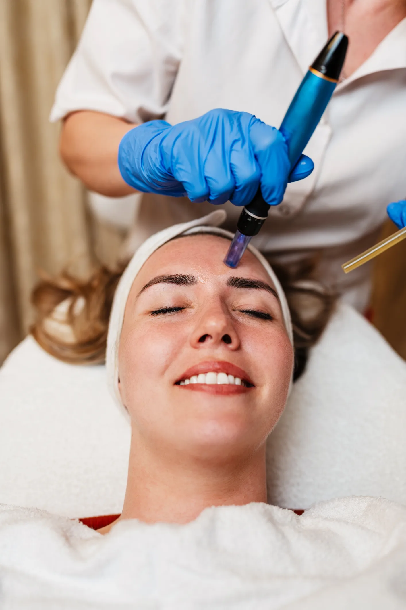 Microneedling — overview