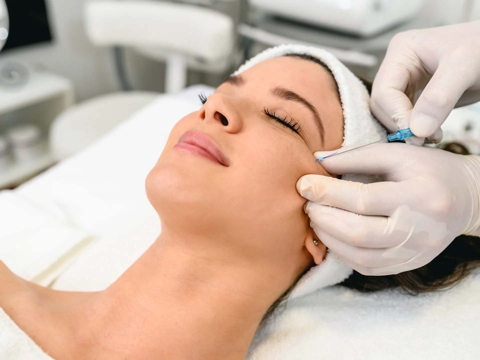 PDO Threads at Younger You Aesthetics — Northern California